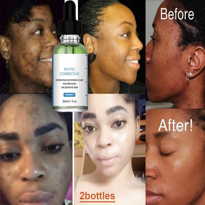 Skin Care Ceuticals Serum 3 Hydrating B5 Moisturize Phyto  Corrective Serums 30Ml 1FL.OZ OEM