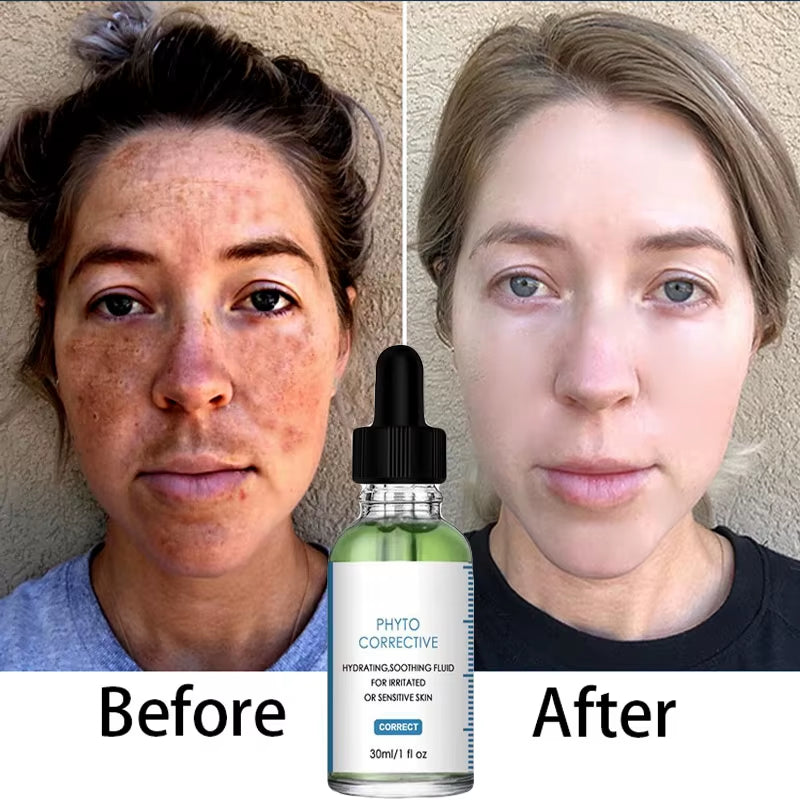 Skin Care Ceuticals Serum 3 Hydrating B5 Moisturize Phyto  Corrective Serums 30Ml 1FL.OZ OEM